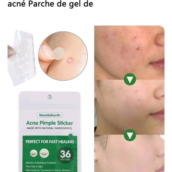 Acné Pimple Sticker. Parche Anti Acné Cont. 36 piezas. actúan como una barrera contra los contaminantes externos, evitando que se infecte y empeore al contacto con tus dedos. Actúan de forma rápida facilitando su cicatrización. Hecho con ingredientes vegetales. - Imagen 3